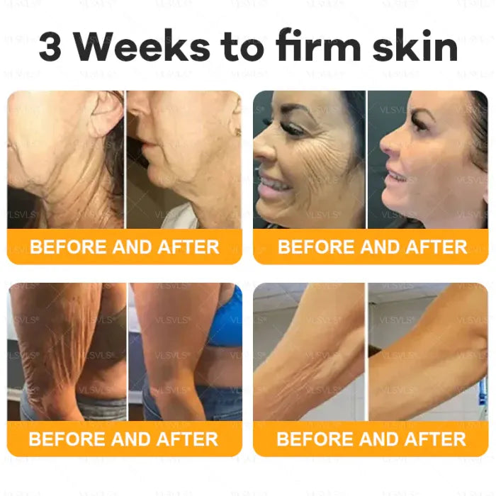 ⏰ POSLEDNÍ DEN 50% SLEVA👩‍⚕️Kompletní krém s včelím jedem