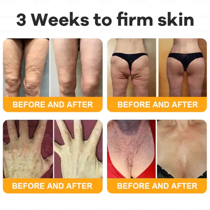 ⏰ POSLEDNÍ DEN 50% SLEVA👩‍⚕️Kompletní krém s včelím jedem