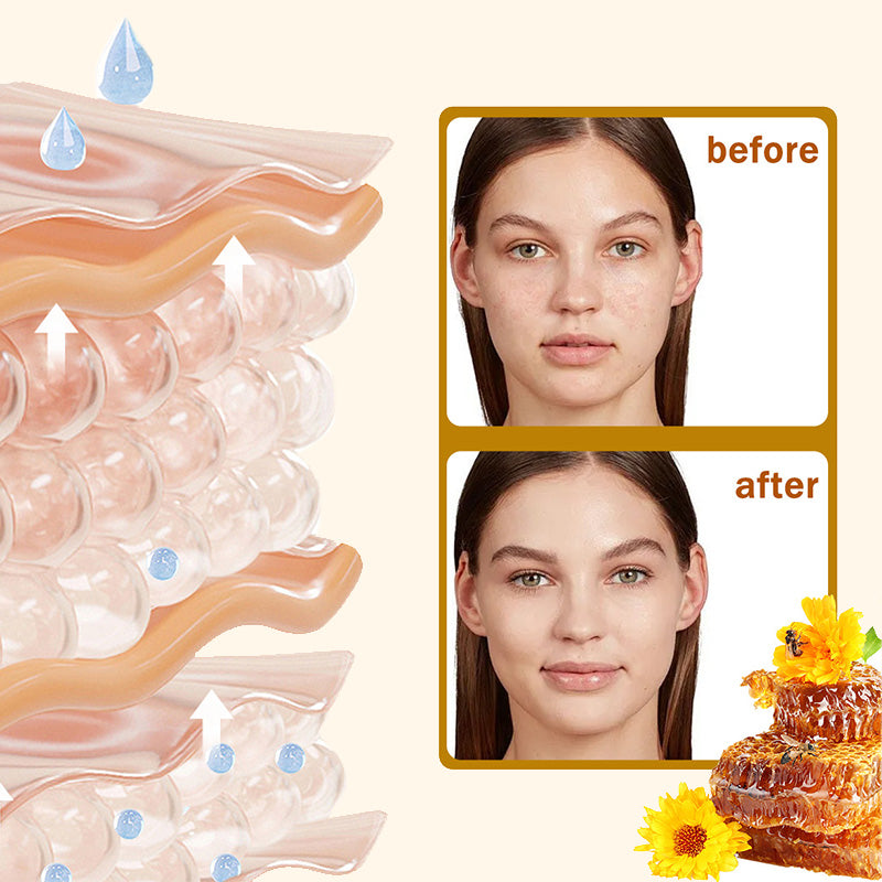 ⏰ POSLEDNÍ DEN 50% SLEVA👩‍⚕️Kompletní krém s včelím jedem