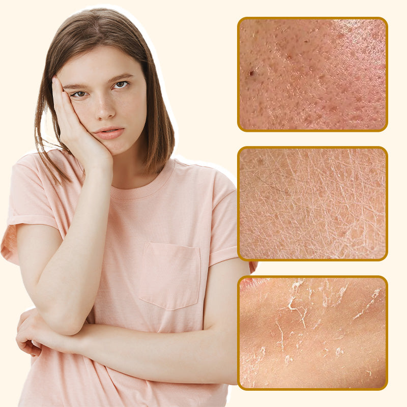 ⏰ POSLEDNÍ DEN 50% SLEVA👩‍⚕️Kompletní krém s včelím jedem